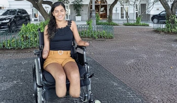 As Quatro Próteses da Letícia