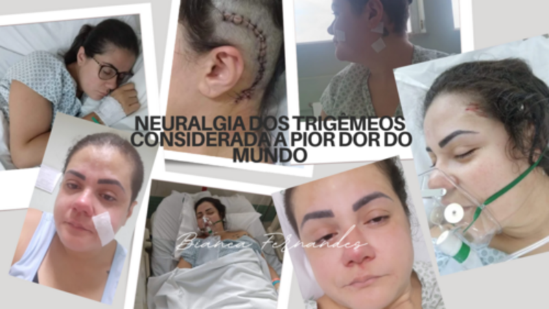 Neuralgia dos trigêmeos 