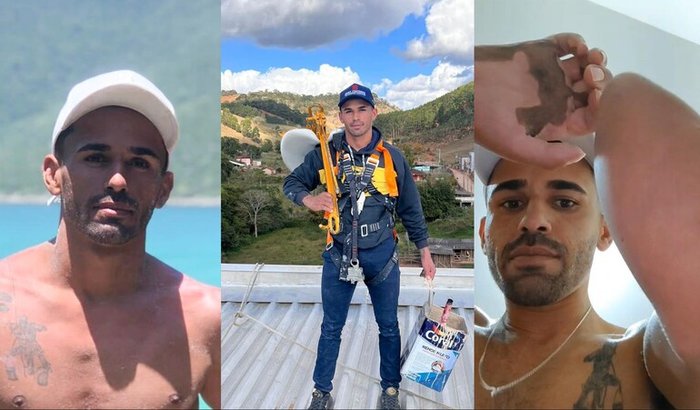 Ajude Devair com uma prótese