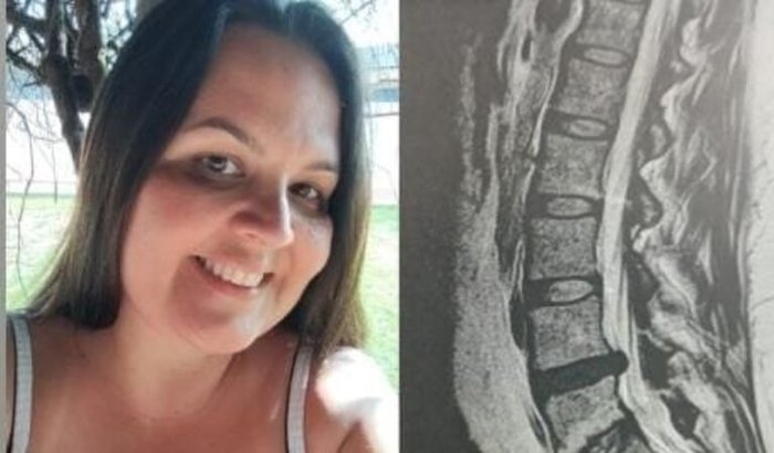 Ajude a Aline a fazer uma cirurgia de hernia de disco.