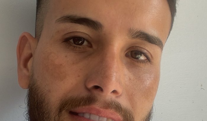 Ajude Bruno realizar cirurgia com urgência, da doença Acalasia esofágica