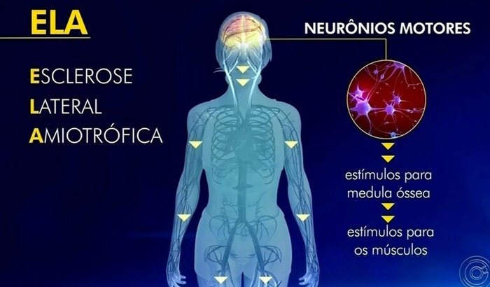 Ajude Betão na Luta contra ELA