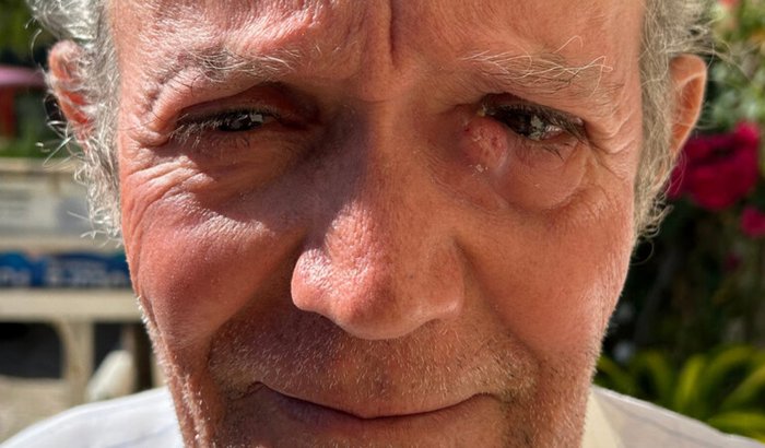 Ajude o senhor João a continuar enxergando.