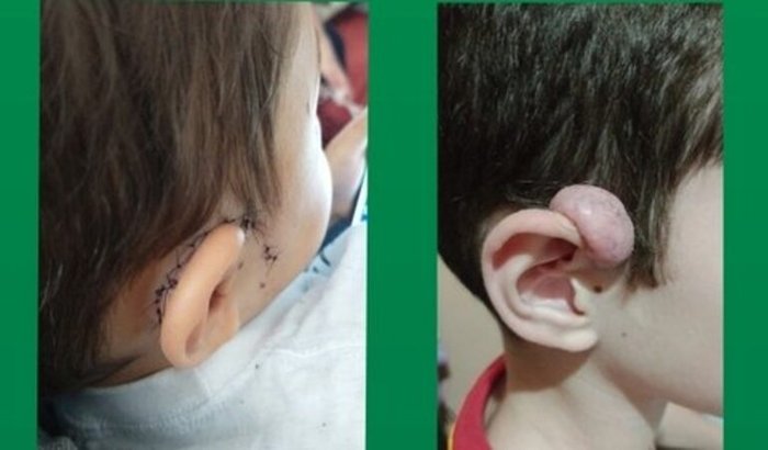 Ajuda para cirurgia do Luan