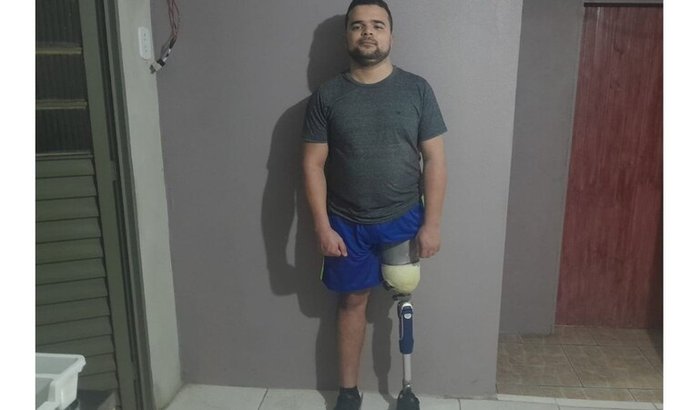 Apoio à manutenção da prótese de William Fagundes