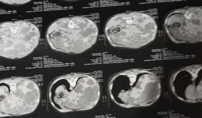 Solidariedade que salva: Apoio a Maiane 🌻