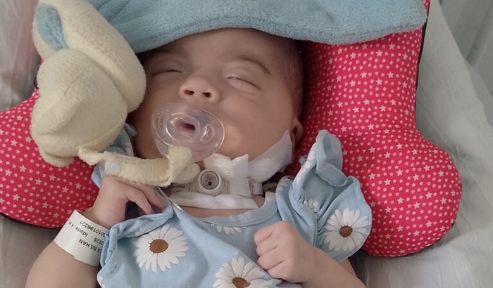 Lívia nossa pequena bebê rara