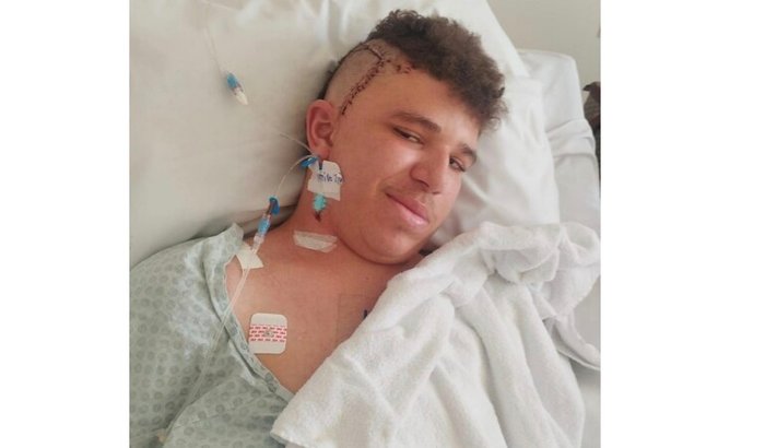 Tratamento Jonathan Câncer glioblastoma cerebral agressivo