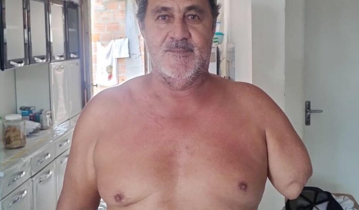 Vaquinha prótese de braço para Paulo