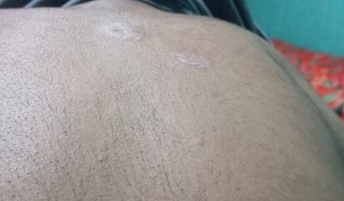 Tomei um golpe no valor de 6mil reais da minha cirurgia