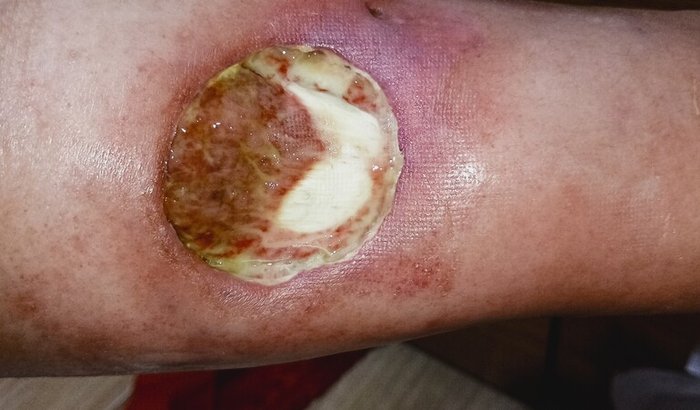 Vaquinha pra ajudar Paty no tratamento