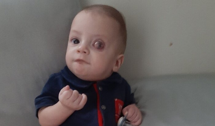 Levi,um milagre ! Preciso de uma cirurgia e protese !