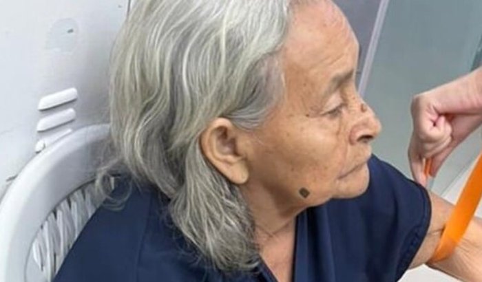 DOIS TUMORES NO PESCOÇO