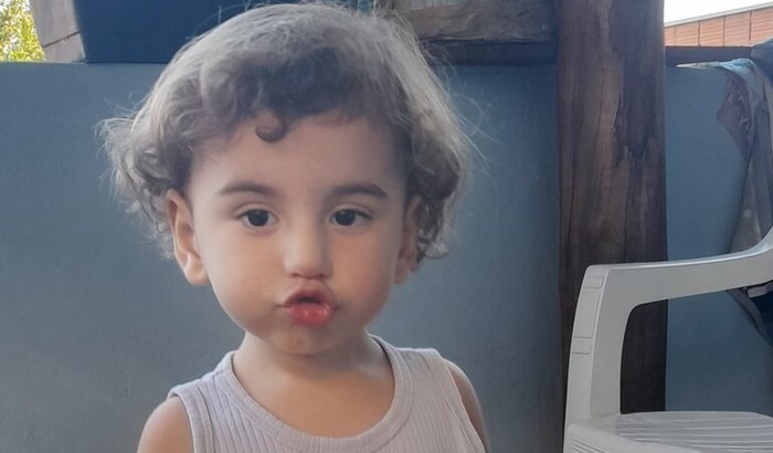 Cirurgia urgente do Davi