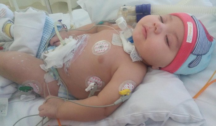 Tratamento Vinícius Sindrome. de West +Erro Inato do Metabolismo