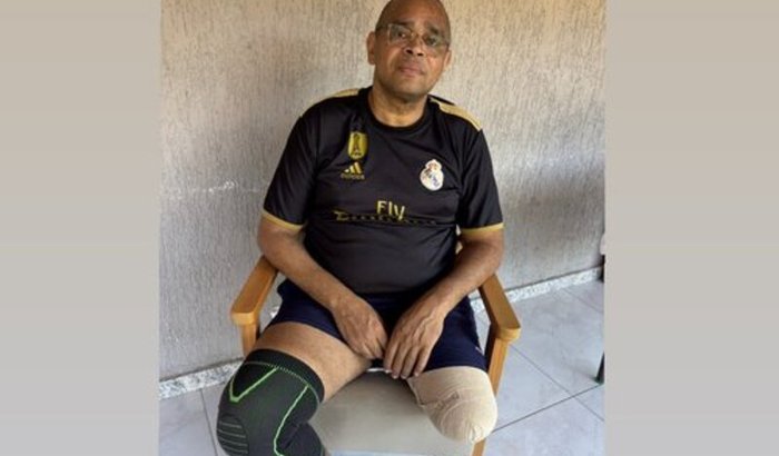 Juntos pela prótese do Rogério