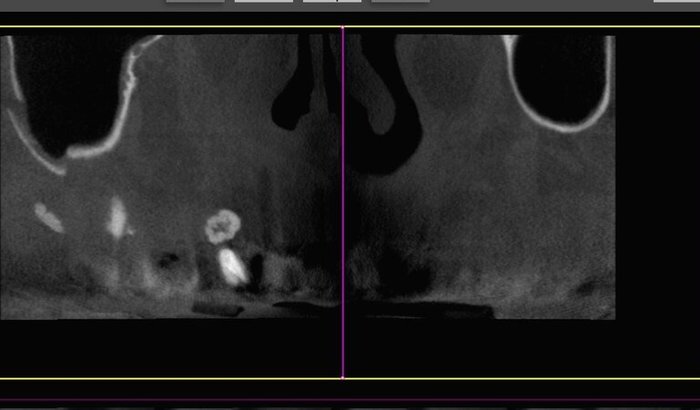 AJUDA URGENTE PARA CIRURGIA DENTÁRIA - MEU SORRISO VIROU UM PESADELO