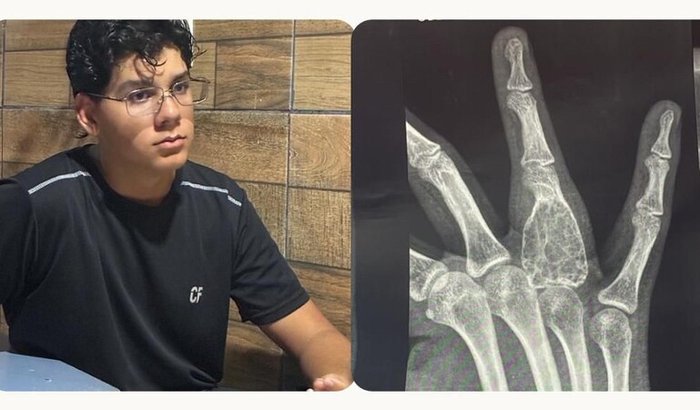 Cirurgia Ediomar Amorim