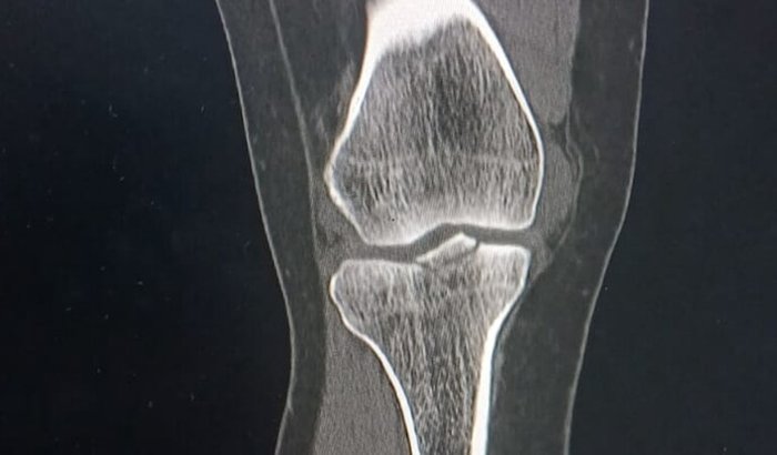 "Solidariedade que cura: vamos ajudar a Elzinha"
