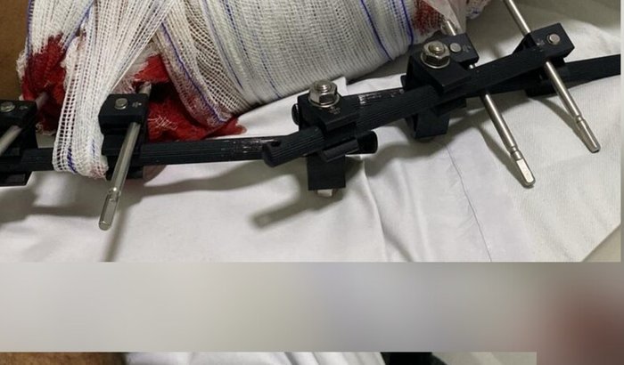 Vaquinha de Apoio para Thales e Jhemesom