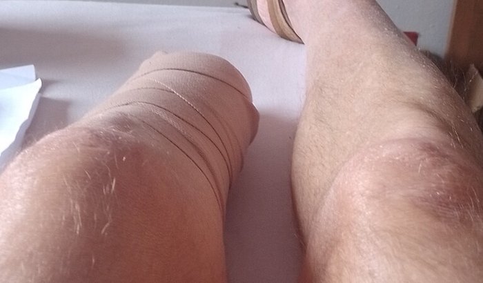 Sua ajuda vai me fazer andar de novo 🦶🙏