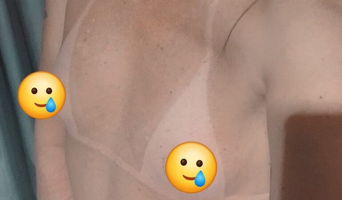 Cirurgia de afirmação de gênero: Contribua com meu recomeço.