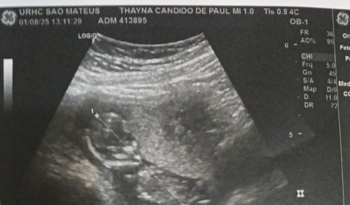 Me ajude ah fazer meu cha de bb e comprar algumas coisas pro bb