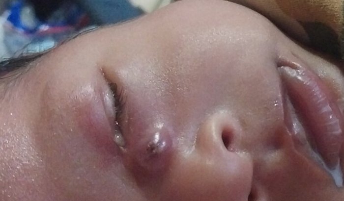 Ajude o henry vieira marquina a enxergar um futuro sem dor!