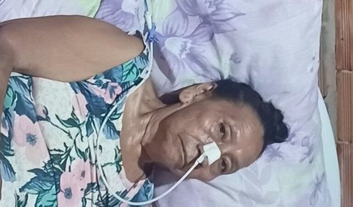 Fazer Prótese dentária