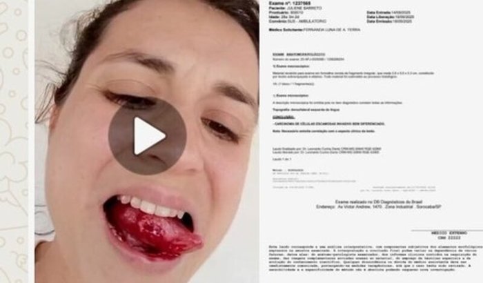 Ajuda para cirurgia da ju