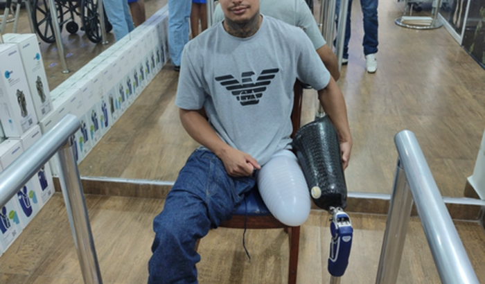 Ajuda para comprar prótese femoral