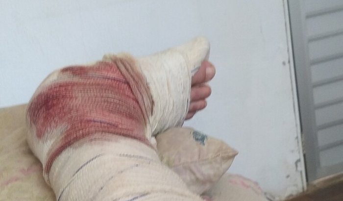 Ajude um motoboy acidentado