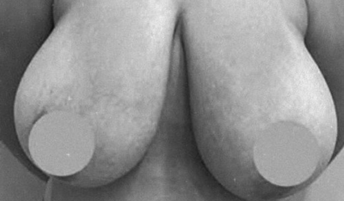 UMA CIRURGIA QUE NÃO PODE MAIS ESPERAR