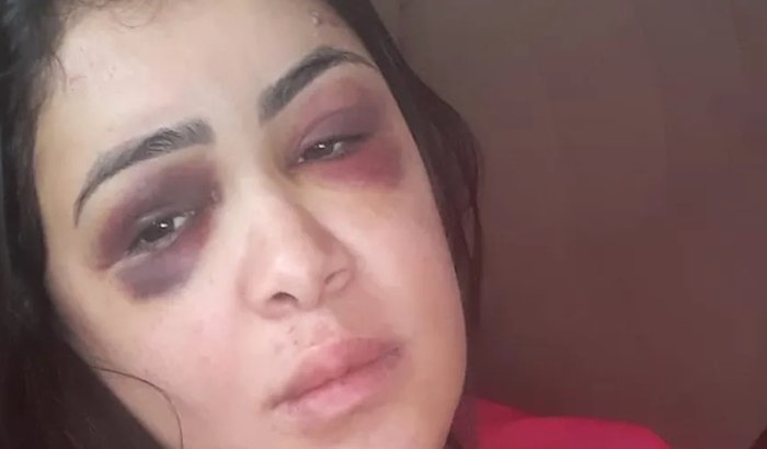 Ajude uma vítima de violência doméstica