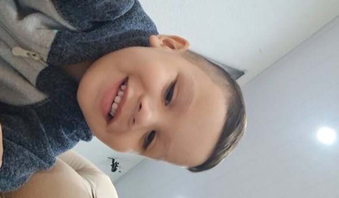 Ajuda de um exame para cirurgia 