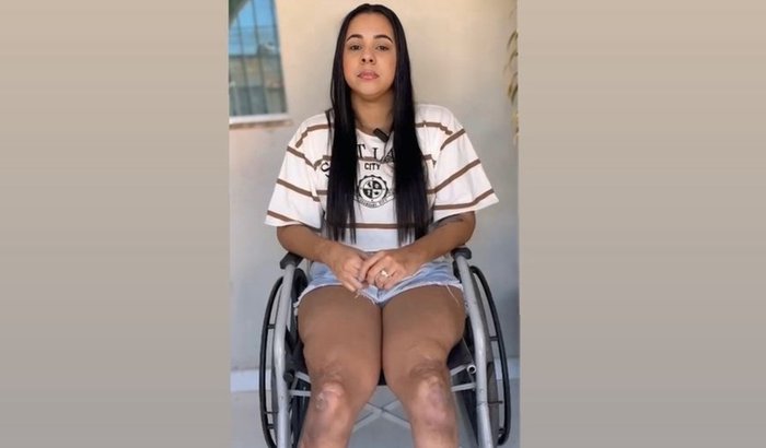 Ajuda Rayane a conquistar duas próteses