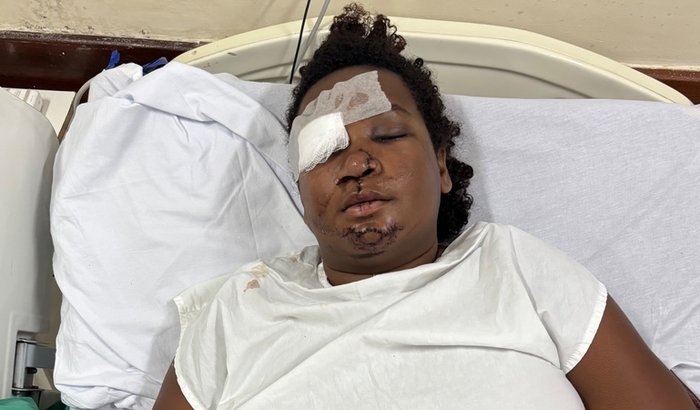 💔 Ajude a Camila na sua recuperação após grave acidente