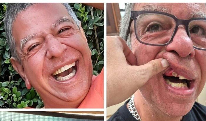 A saúde começa pela boca: ajude o Joca a voltar a sorrir, se alimentar e viver com saúde.