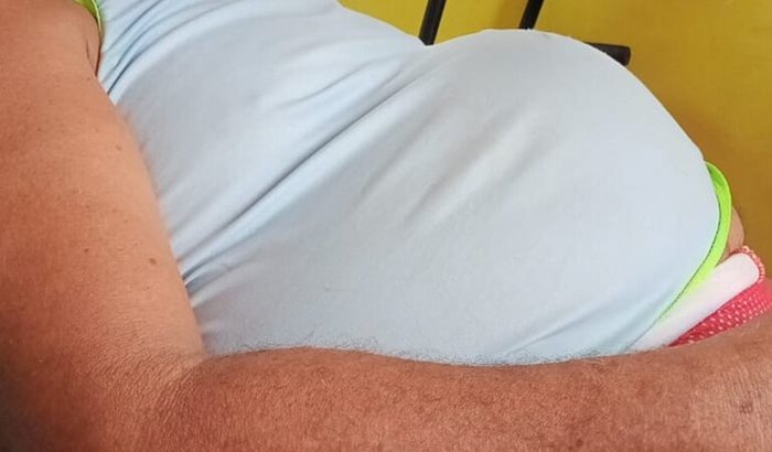 Cirurgia de Hérnia Hyran do Axé