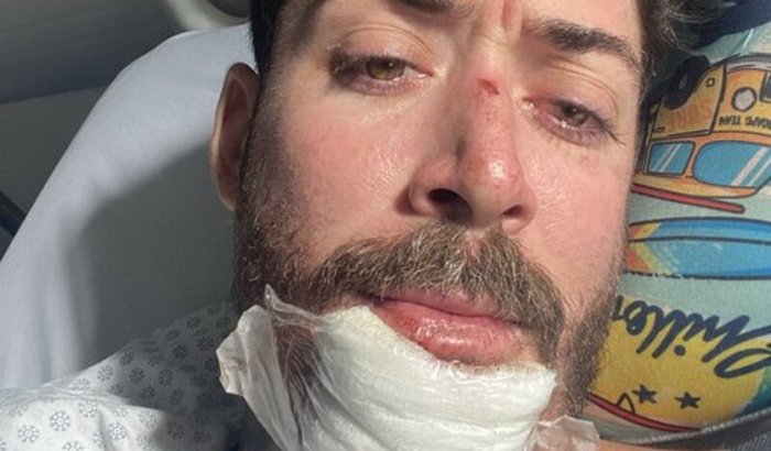 Gastos da recuperação do meu acidente,  quebrei o femur,  alguns dentes e faturei o quixo 