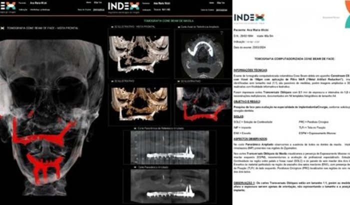 PRECISO DE CIRURGIA BUCOMAXILOFACIAL, URGÊNCIA!