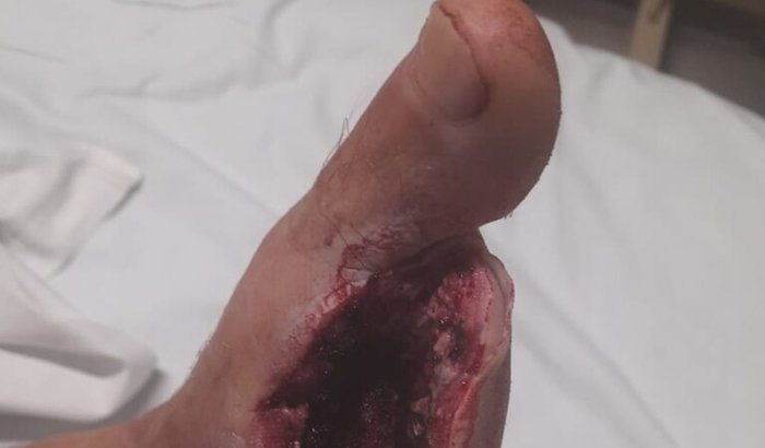 Ajuda para medicamento 