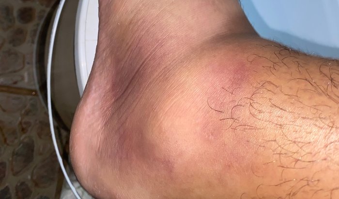 Vaquinha na ajuda para Robert(Robin)