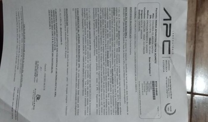 Tratamento de câncer de mama