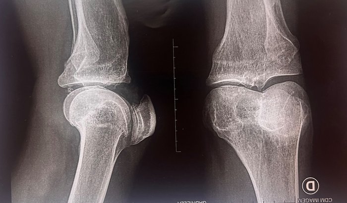 Salve os Passos do Campeão Veiga!