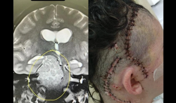 Ajuda pra Reabilitação 