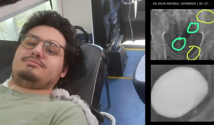 Juntos pela melhora do Leo!