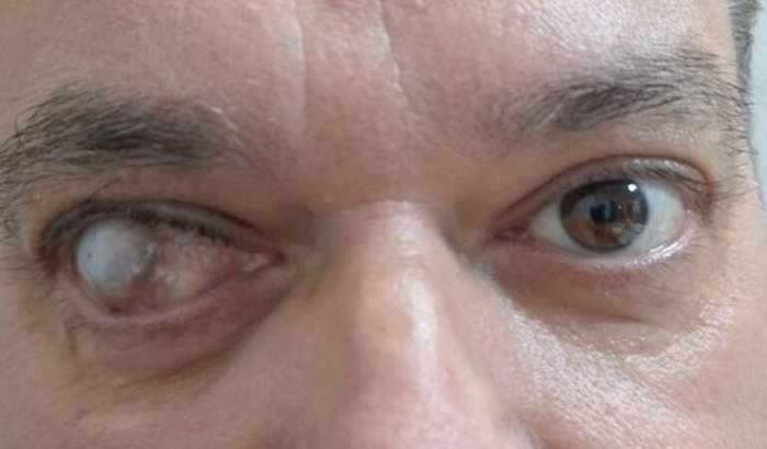 SALVE A VISÃO DO ADILSON