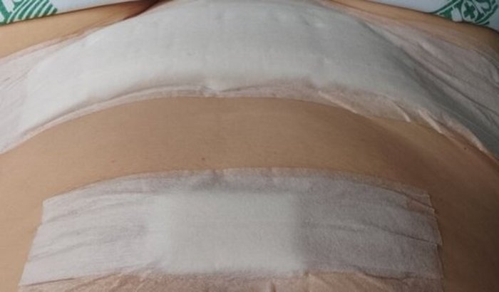 Gastos com farmácia/remédios para dor e agora pós cirúrgico