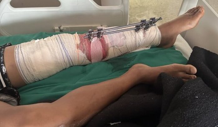 Ajuda para despesas médicas 